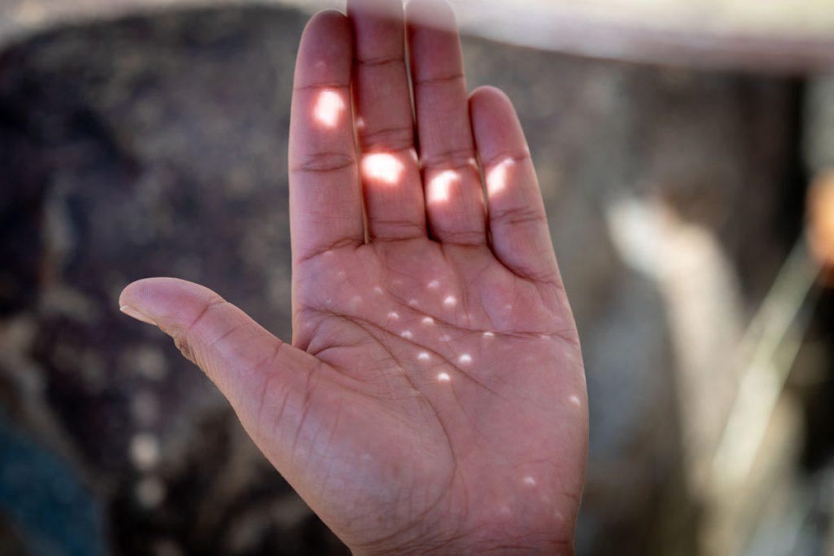 An eclipse chaser projects the shadows of the April 8 2024 solar eclipse onto their hand, Nazas, Mexico. Credit: Edwin Remsberg/VWPics/Universal Images Group via Getty Images